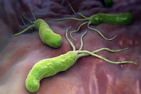 بعد علاج جرثومة المعدة- نصائح لمنع عودتها