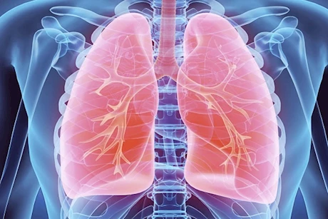 علامة في أطراف أصابعك تدل على مشكلة خطيرة في الرئة