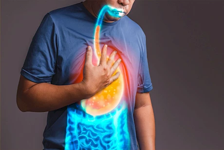 طبيب يكشف المشروبات الممنوعة على مريض ارتجاع المريء