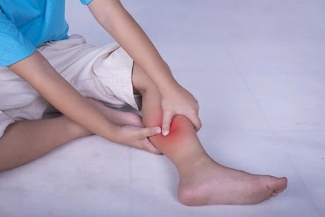 وداعًا لتقلصات الساقين- 6 مكملات غذائية لعلاجها