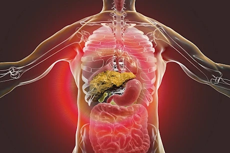 عند إصابتك في هذا المكان بجسدك.. 5 علامات قوية تكشف عن وجود "تليف الكبد"