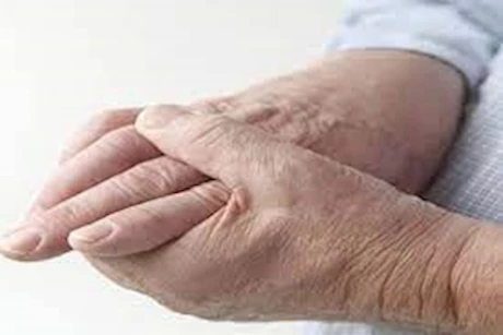 طبيب يوضح أعراض جلطات البطن والرئة؟