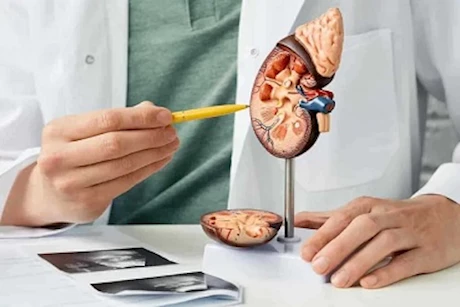 أورام الكلى.. إليك الأسباب والعلاج 