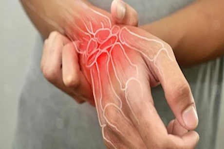 أعراض تنذرك بالتهاب المفاصل.. احذرها 