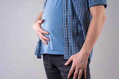 بعد الرنجة والفسيخ- 6 علاجات منزلية لانتفاخ البطن