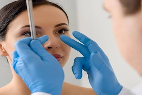 تضخم قرنيات الأنف - إليك الأعراض وطرق العلاج