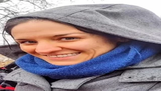 صور صادمة.. امرأة تدعي تغير لون بشرتها بسبب طعام شهير 