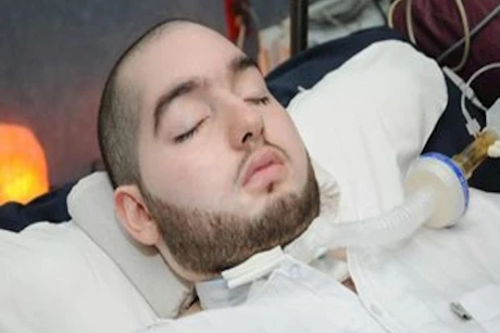 نزيف الدماغ.. قاتل صامت حوّل حياة الأمير النائم لمأساة