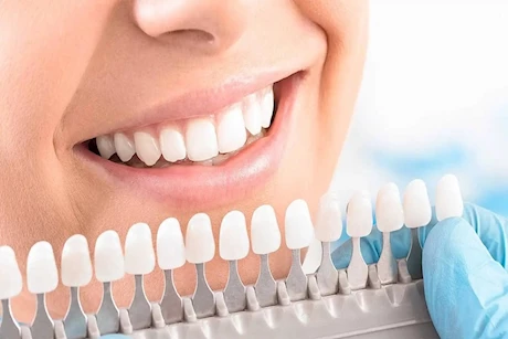 لحماية أسنانك من التآكل..  اتبع هذه النصائح 