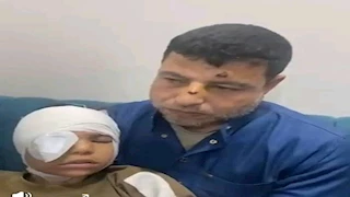 طفلة فقدت عينها.. قرار عاجل من المحكمة بشأن الصبية المتهمين برشق قطار أشمون بالحجارة
