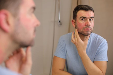 الطفح الجلدي عند الشعور بالتوتر.. إليك الأسباب