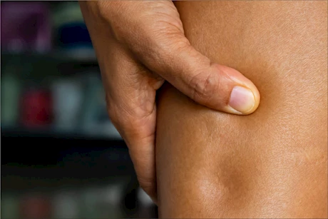 انتفاخ الجلد.. إليك طرق العلاج