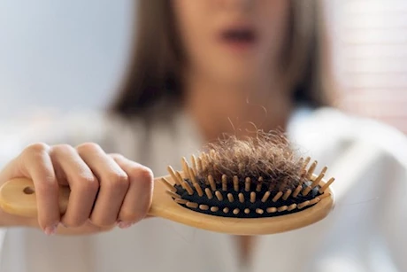 هل الأنيميا تسبب تساقط الشعر؟