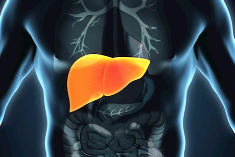 في أسبوعين فقط- 8 مشروبات لعلاج دهون الكبد