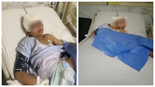 فقد عينيه في مسلسل انتقام.. إصابة طفل بخرطوش أطلقه خارجون عن القانون بالشرقية