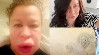 في منزلك.. صور سيلفي تكشف عن القاتل الصامت - يدمرك دون أن تدري