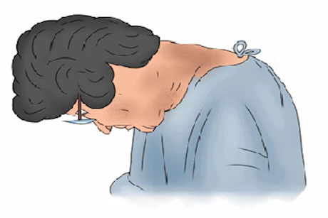 متلازمة الرأس المتدلي.. إليك الأسباب