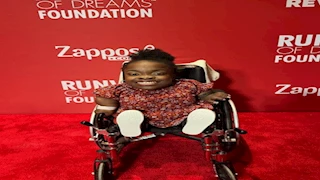 من كرسي متحرك إلى منصات الأزياء.. 15 صورة لـ أقصر عارضة أزياء في العالم 