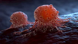 فاكهة تحارب السرطان وتقوي جهازك المناعي.. تحميك من الأمراض 