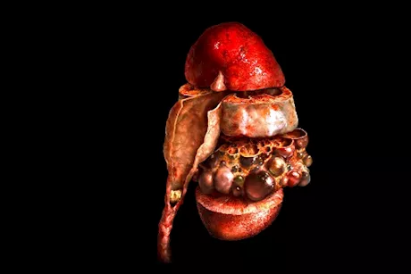 الفشل الكلوي- أسبابه وأعراضه وعلاجه | دليل شامل