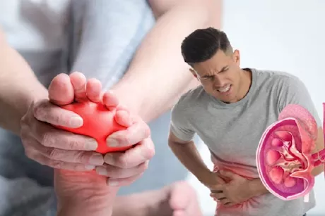 تظهر على القدمين- 5 أعراض لتليف الكلى احذرها