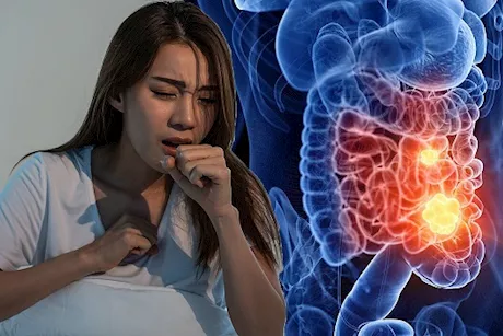 أعراض سرطان القولون لدى النساء – علامات يجب الانتباه لها