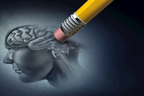 احذر- 6 عادات خاطئة تصيبك بألزهايمر