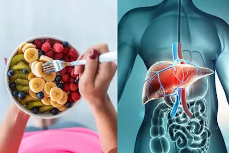 مرض الكبد الدهني- 7 فواكه قد تعالجك منه