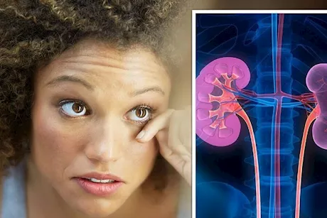 تظهر في العين- 4 أعراض تكشف إصابتك بتلف الكلى 