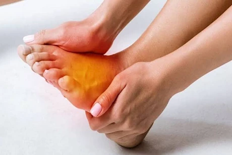 "ارتفاع ضغط الدم" أبرزها.. 5 حالات صحية تؤدي إلى حرقة القدم