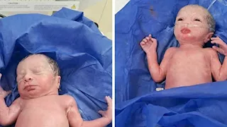 لأول مرة.. ولادة 3 توائم بمستشفى العدوة المركزي في المنيا (صور)