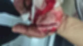 "أثناء خروجه من المسجد".. النيابة تحقق في واقعة اعتداء مسجل خطر على موظف بحلوان