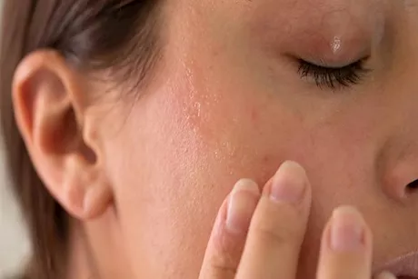 كيف تحمي بشرتك من الشتاء؟