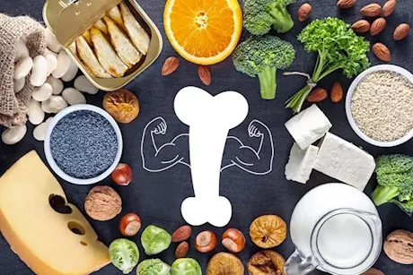 في 30 يومًا- 3 أطعمة لعلاج ضعف العظام