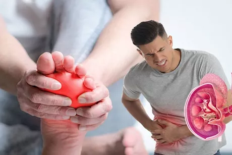 تحدث ليلًا- 7 أعراض لحصوات الكلى تظهر على القدمين