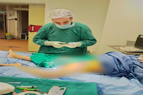 إنقاذ طفل مريض بالفشل الكلوي بعد 10 أيام من التوقف التام عن الغسيل الدموي