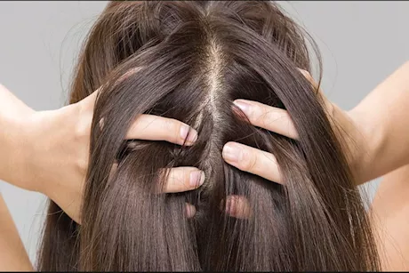 فوائد زيت بذور الكاميليا لصحة الشعر- هل يحقق نتائج فعالة؟ 