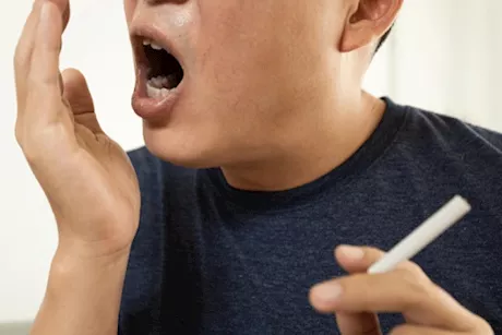 التدخين يجعل رائحة فمك كريهة- 5 نصائح للتخلص منها