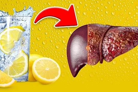 هل الماء بالليمون يذيب دهون الكبد؟