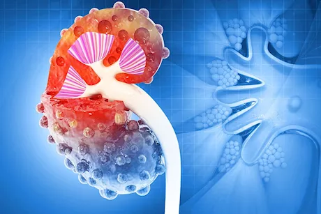 انتبه- 6 علامات خفية تكشف إصابتك بالفشل الكلوي