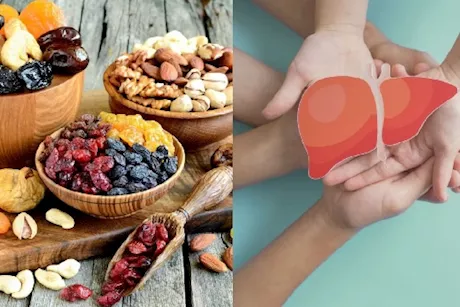 للوقاية من مرض الكبد الدهني- 4 مكسرات تناولها يوميًا