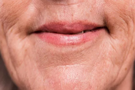 هل يشيخ فمك أسرع منك؟ انتبه لهذه العلامات التحذيرية