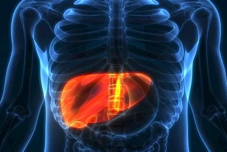 مثبتة علميًا- 6 طرق لعلاج مرض الكبد الدهني