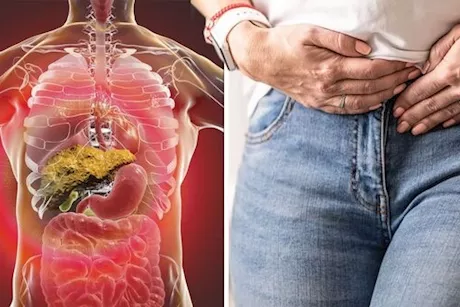 تحدث في معدتك- 5 أعراض لمرض الكبد الدهني احذرها
