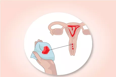 حسام موافي يحذر النساء: النزيف المهبلي عرض لهذه الأمراض