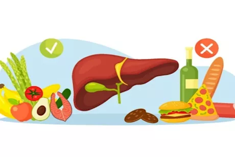 لمرضى الكبد الدهني- إليك أفضل وأسوأ الأطعمة لصحتك