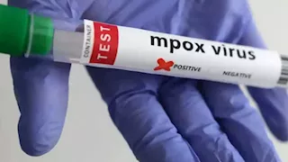 غانا تسجّل أول وفاة بفيروس "إمبوكس" 