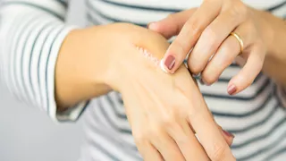 لماذا نشعر بالألم حتى بعد زوال سببه؟