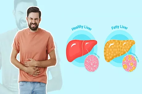 لا تقترب من هذه الأطعمة.. تفاقم مخاطر الكبد الدهني