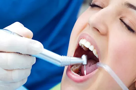 التنظيف العميق للأسنان لا يُبيض أسنانك.. وهذا ما يفعله  لصحة فمك
